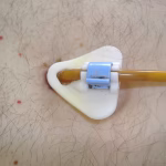 enteral feeding