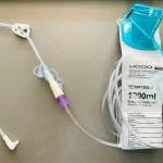 peg tube system