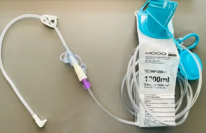 peg tube system