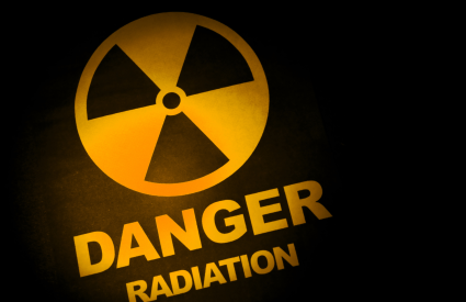 radiation exposure